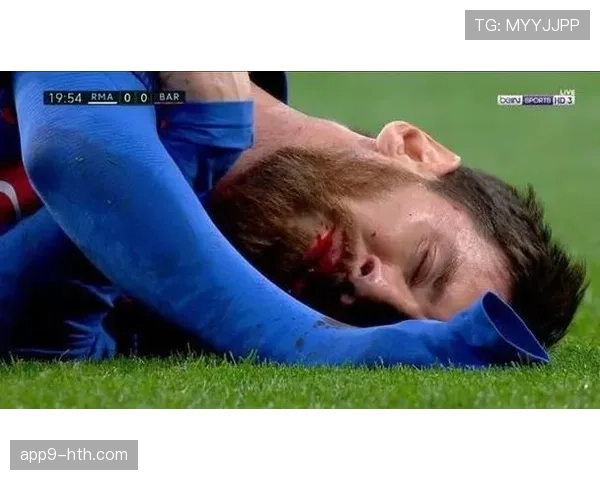 汉堡后卫魏泽因伤缺席，边路防守受影响